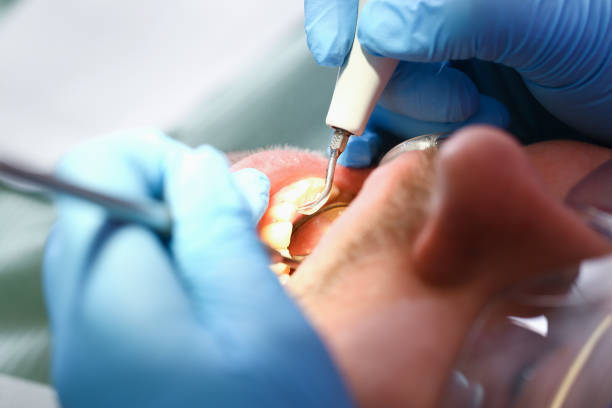  Mcqueeney, TX Emergency Dentist Pros