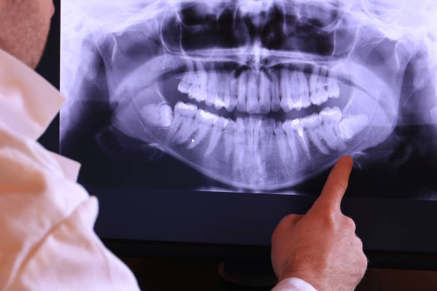 Best Emergency Dental Care for Broken or Chipped Teeth in Mcqueeney, TX