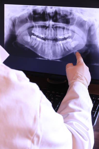 Best Emergency Root Canal Treatment in Mcqueeney, TX