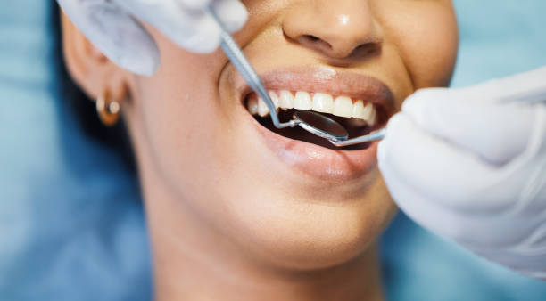 Best Emergency Dental Care for Broken or Chipped Teeth in Mcqueeney, TX