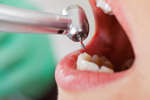 Best Emergency Gum Treatment in Mcqueeney, TX